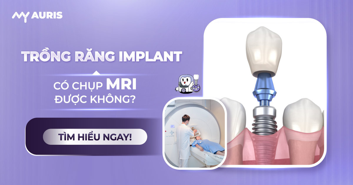 trồng răng implant có chụp mri được không