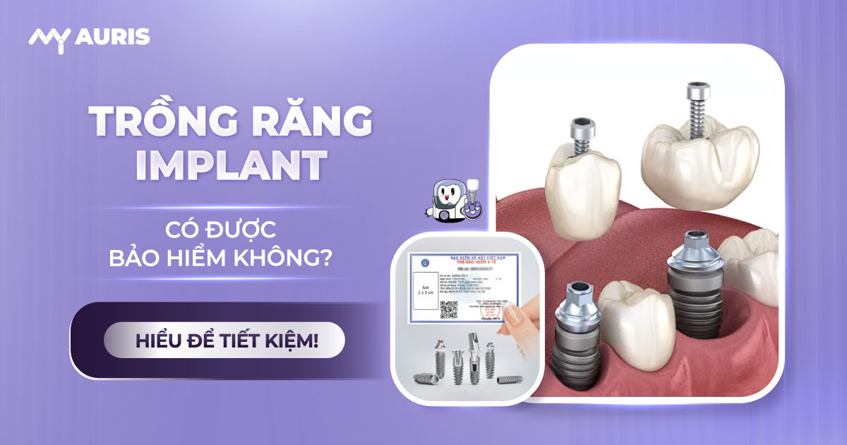 trồng răng implant có được bảo hiểm không