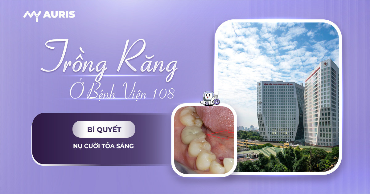 Trồng răng implant ở bệnh viện 108