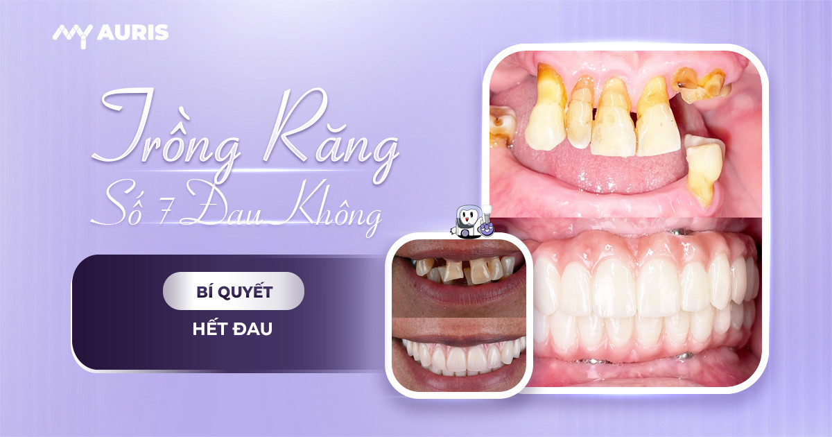 Trồng răng số 7 có đau không