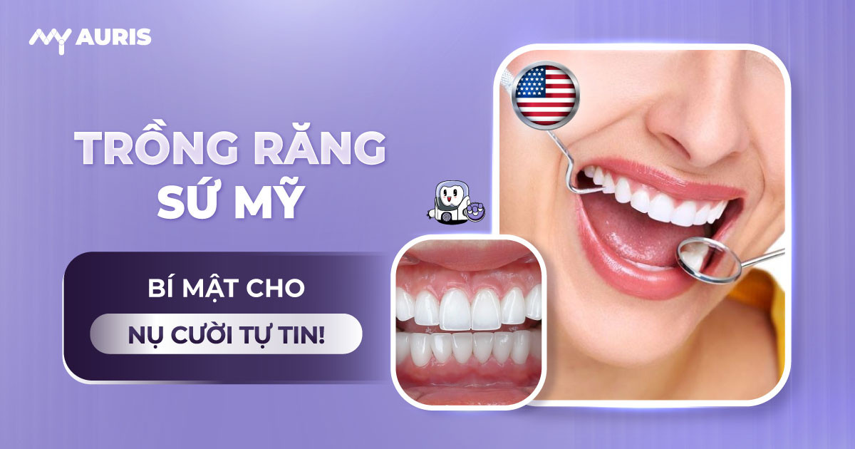 trồng răng sứ mỹ