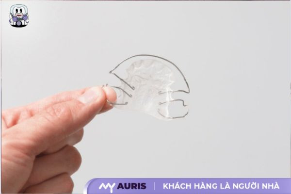 niềng răng tháo lắp kim loại cho người lớn
