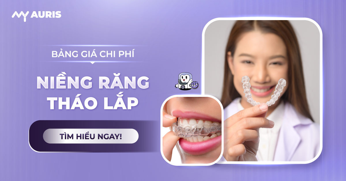bảng giá chi phí niềng răng tháo lắp