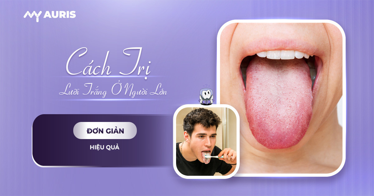 Cách trị lưỡi trắng ở người lớn