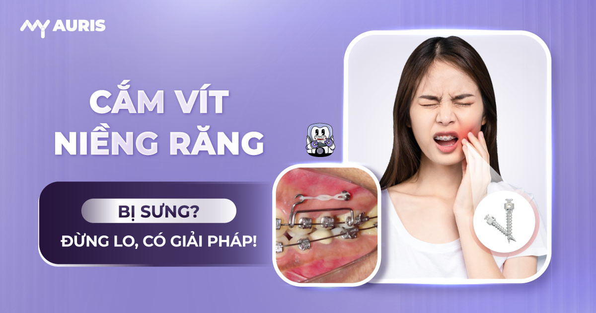 cắm vít niềng răng bị sưng