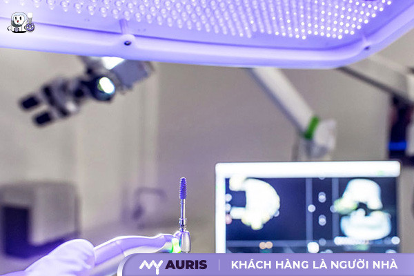 công nghệ trồng răng implant,có ai trồng răng implant chưa,công nghệ trồng răng implant không đau,công nghệ trồng răng mới,trồng răng công nghệ implant