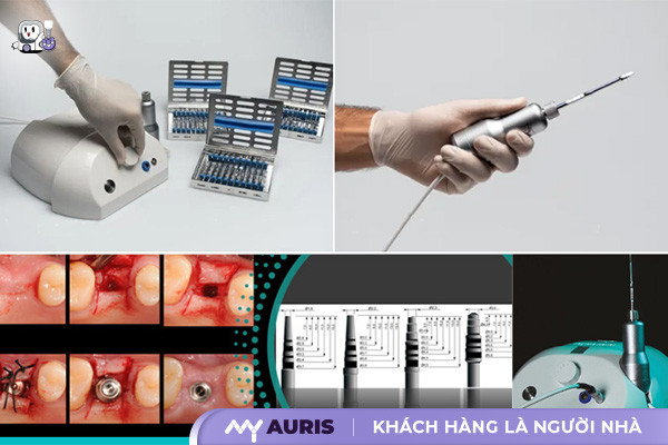 công nghệ từ tính trong cấy ghép implant,công nghệ cấy ghép implant