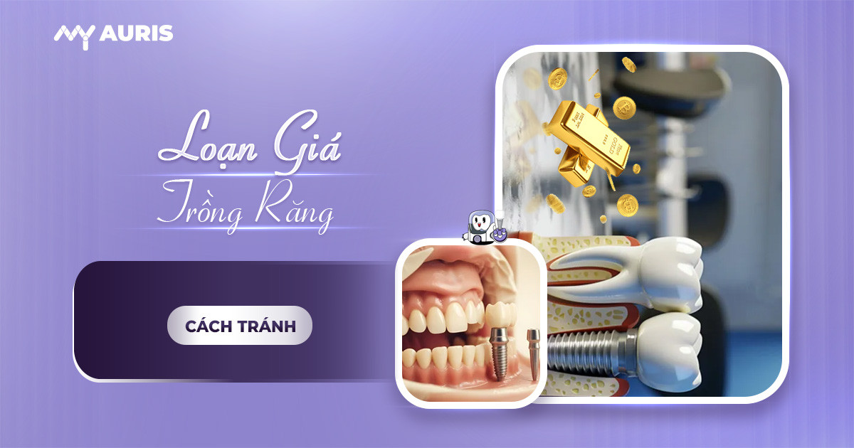 loạn giá trồng răng implant