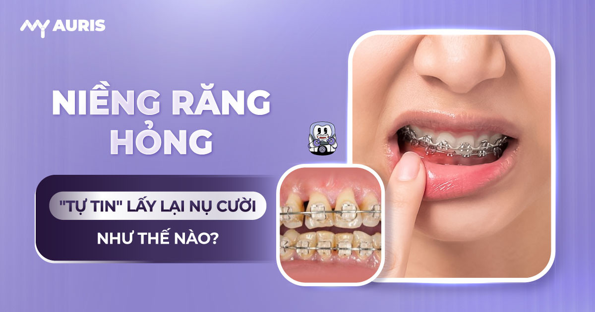 niềng răng hỏng