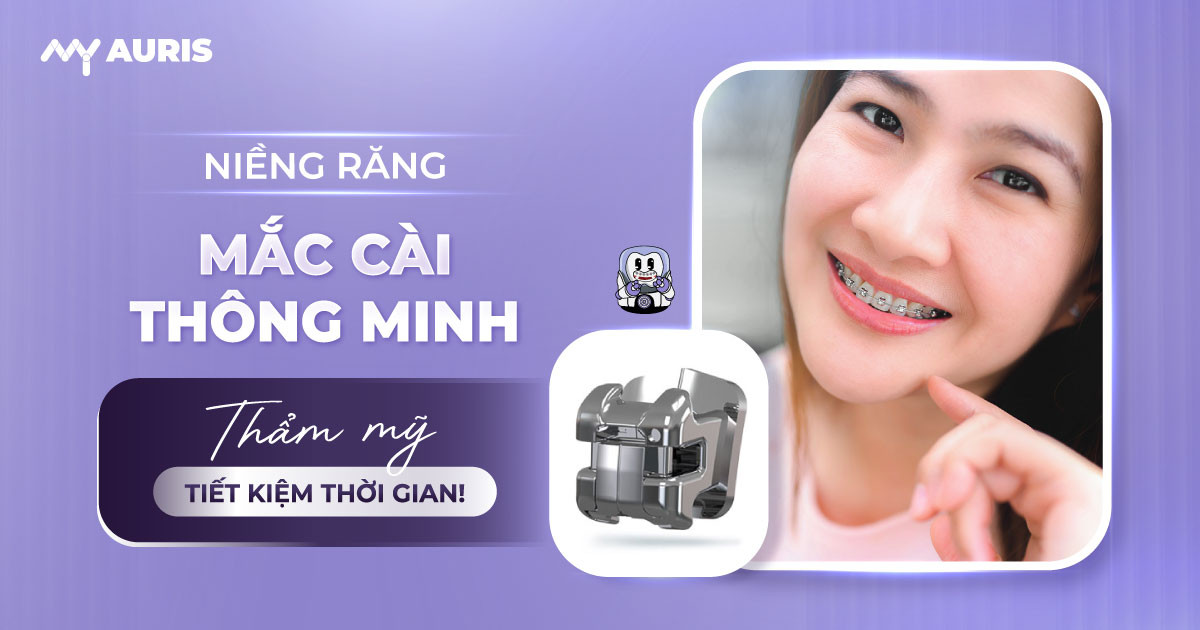 niềng răng mắc cài thông minh