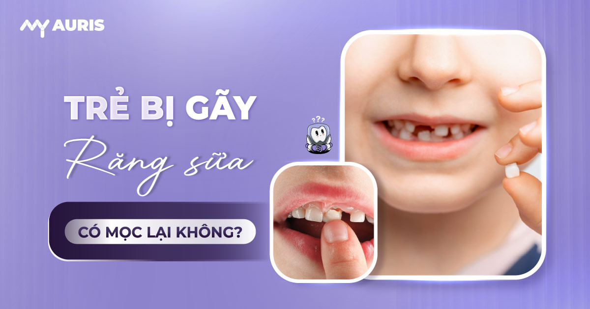 trẻ bị gãy răng sữa có mọc lại không
