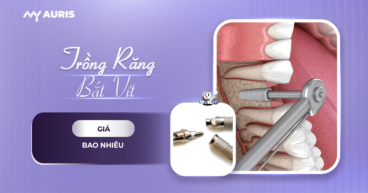 trồng răng bắt vít giá bao nhiêu,trồng răng bắt vít
