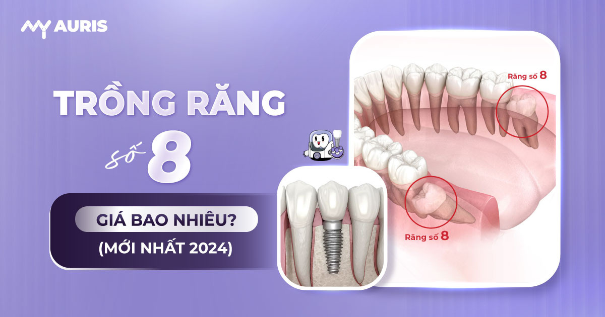 trồng răng số 8 hết bao nhiêu tiền ,có nên trồng răng số 8,trồng răng cùng,trồng răng hàm số 8 giá bao nhiêu,trồng răng khôn,trồng răng khôn bao nhiêu tiền,trồng răng số 8