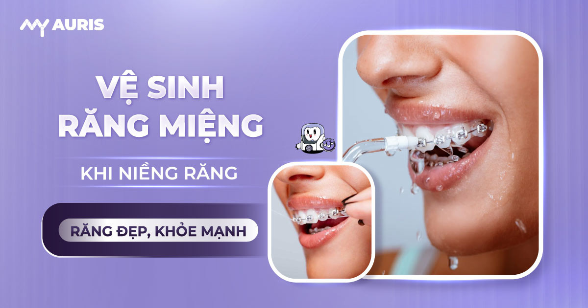 vệ sinh răng miệng khi niềng răng