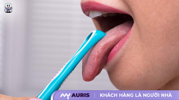vệ sinh răng niềng,vệ sinh răng miệng khi niềng răng