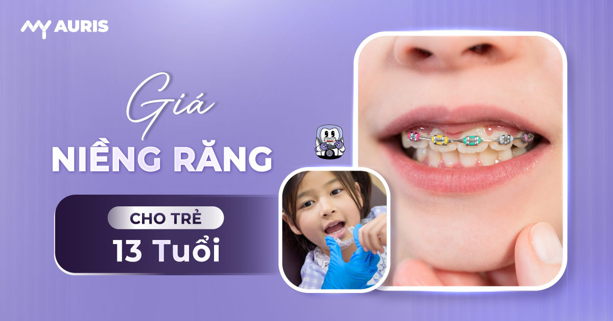 13 tuổi niềng răng bao nhiêu tiền,giá niềng răng cho trẻ 13 tuổi,niềng răng cho trẻ 13 tuổi