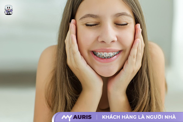 17 tuổi niềng răng,17 tuổi niềng răng bao lâu,17 tuổi niềng răng bao nhiêu tiền
