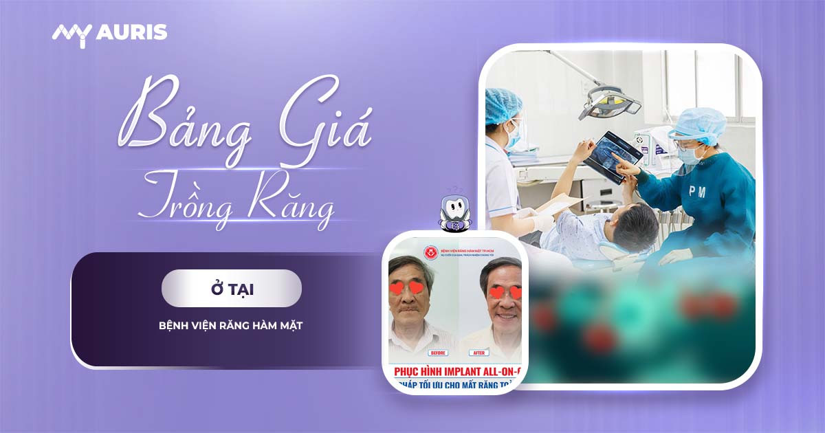 bảng giá trồng răng implant bệnh viện răng hàm mặt