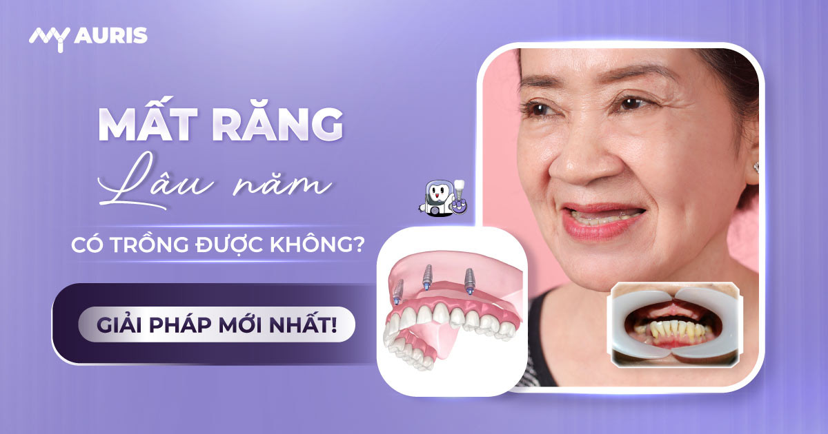 mất răng lâu năm có trồng được không,mất răng lâu năm có trồng implant được không