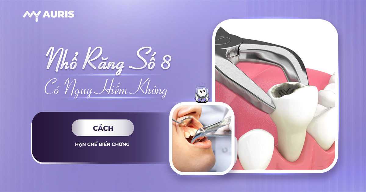 nhổ răng số 8 có nguy hiểm không