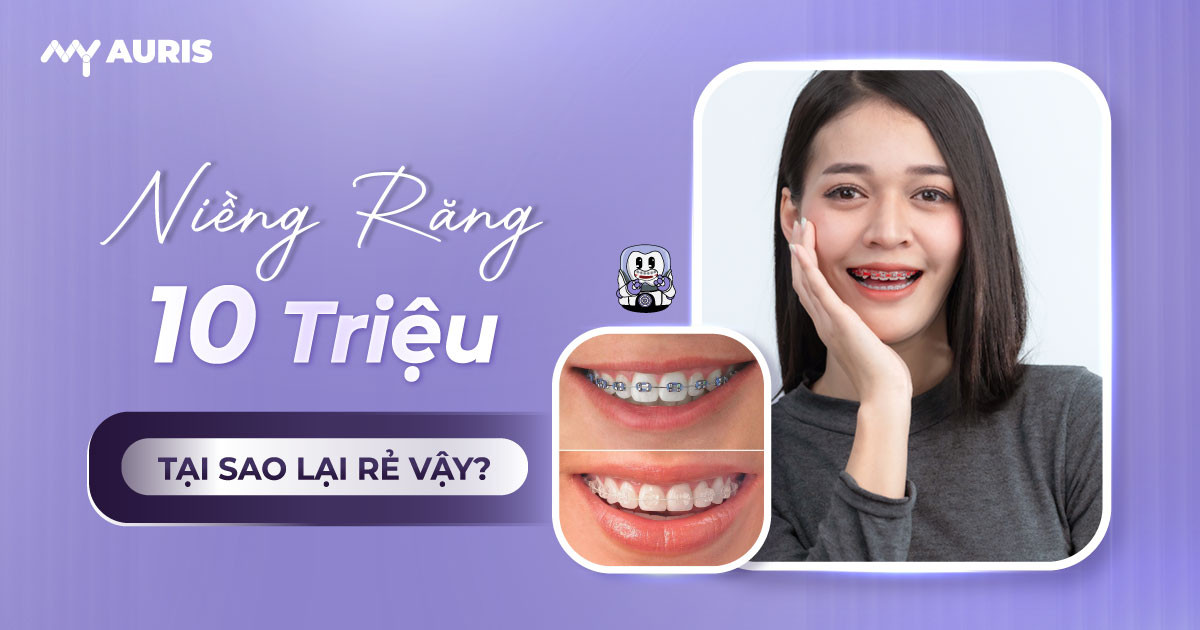 niềng răng 10 triệu