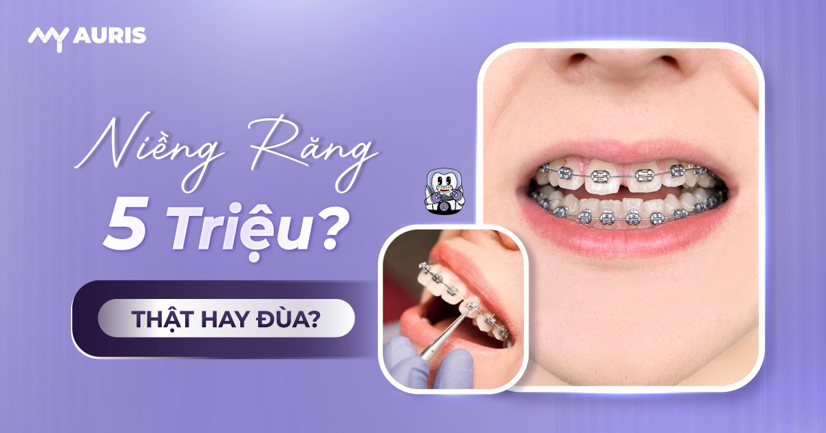 niềng răng 5 triệu