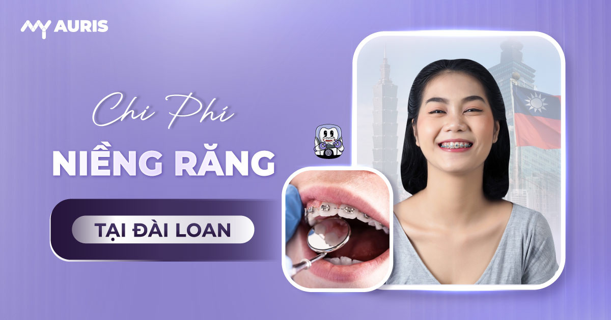 niềng răng mắc cài ở Đài Loan