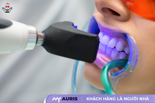 răng sứ có tẩy trắng được không