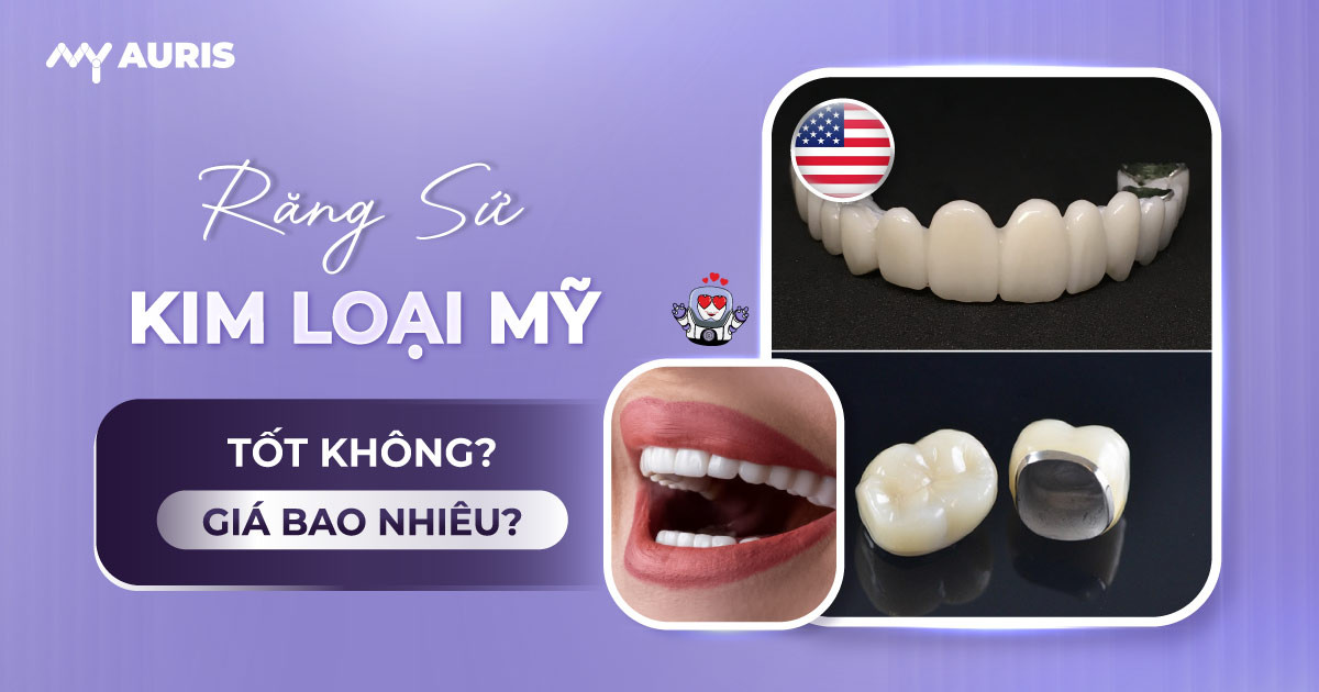 răng sứ kim loại mỹ,răng sứ kim loại mỹ có tốt không