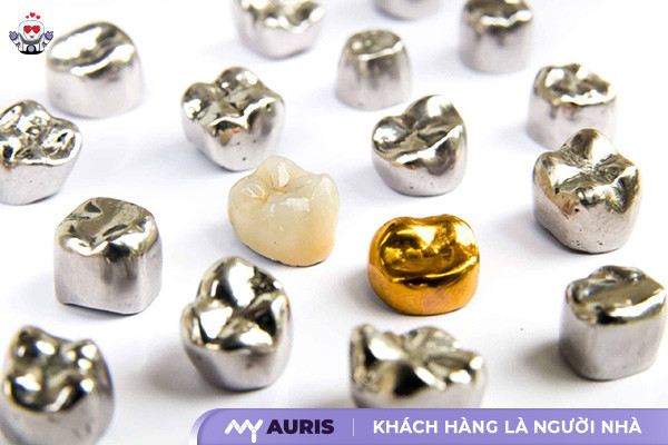 Răng sứ kim loại quý,nên bọc răng sứ loại nào,bọc răng sứ loại nào tốt,bọc răng sứ nào tốt,nên bọc răng sứ loại nào tốt