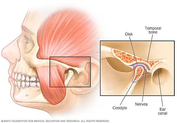 Rối loạn khớp thái dương hàm