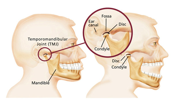 Rối loạn khớp thái dương hàm