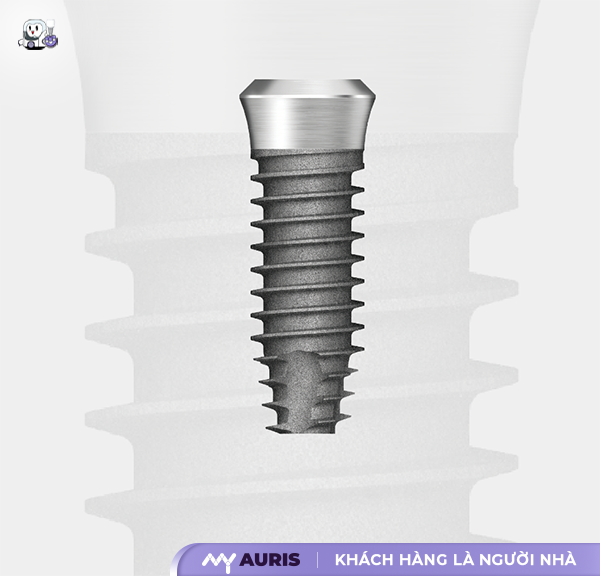 trồng răng implant có mấy loại,cấy implant loại nào tốt,hậu quả trồng răng sứ,nên cắm implant loại nào,trồng răng có mấy loại,trồng răng implant loại nào tốt