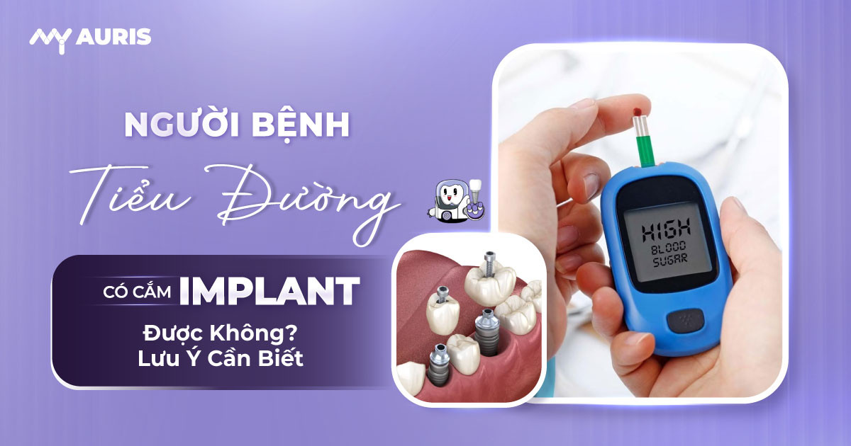 tiểu đường có cắm implant được không