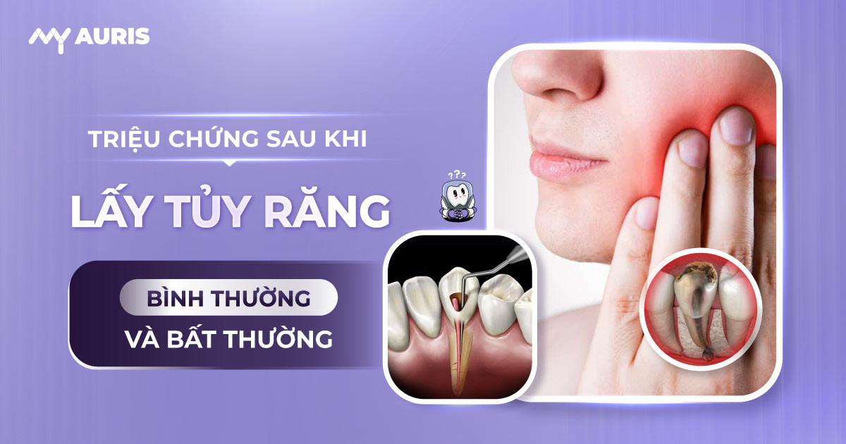 trieu-chung-sau-khi-lay-tuy-rang-20-1-25