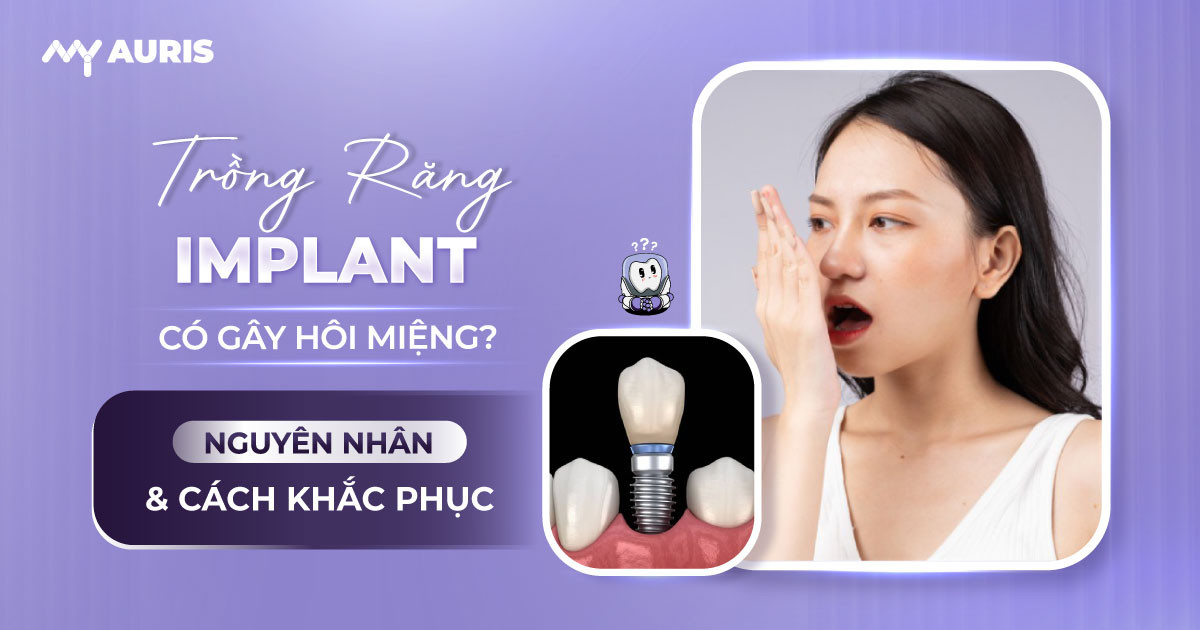 trồng răng implant có bị hôi miệng không,cấy implant có bị hôi miệng không