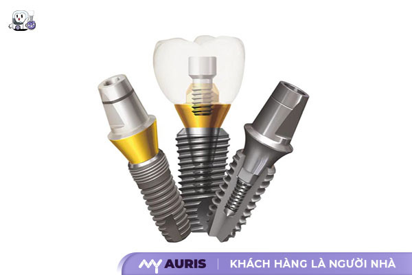 trồng răng implant có mấy loại,cấy implant loại nào tốt,hậu quả trồng răng sứ,nên cắm implant loại nào,trồng răng có mấy loại,trồng răng implant loại nào tốt