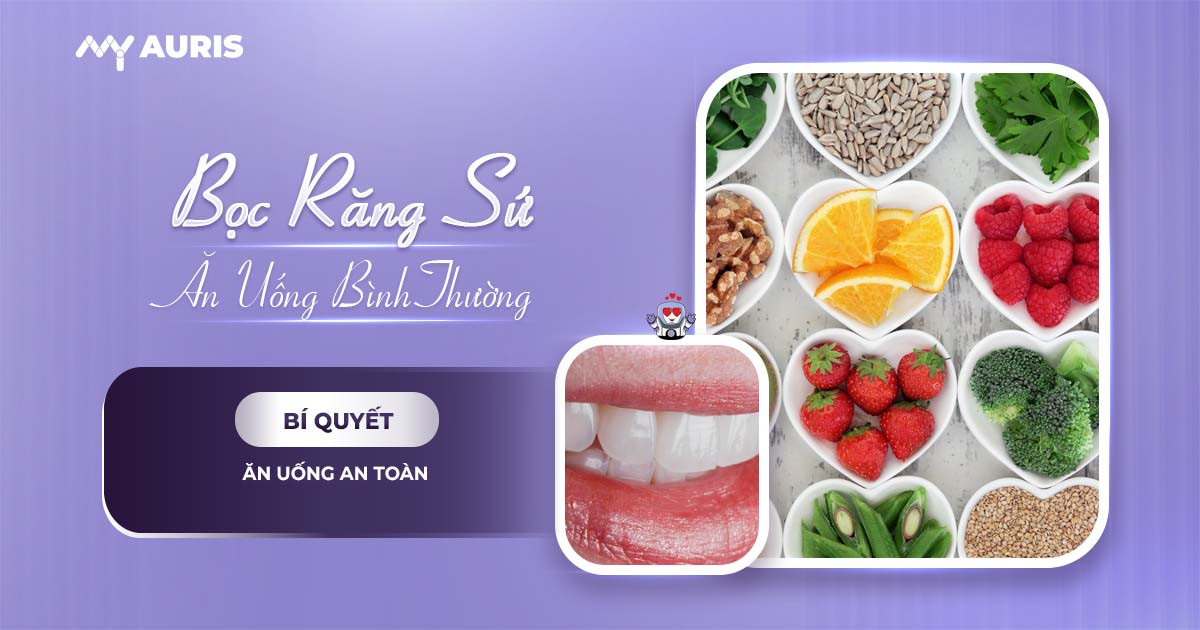 Bọc răng sứ bao lâu thì ăn được