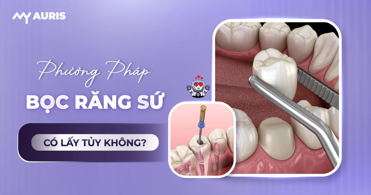 bọc răng sứ có lấy tủy không