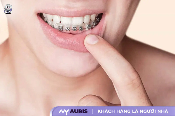 nieng-rang-1-ham-tren-co-duoc-khong-13-2-25-01