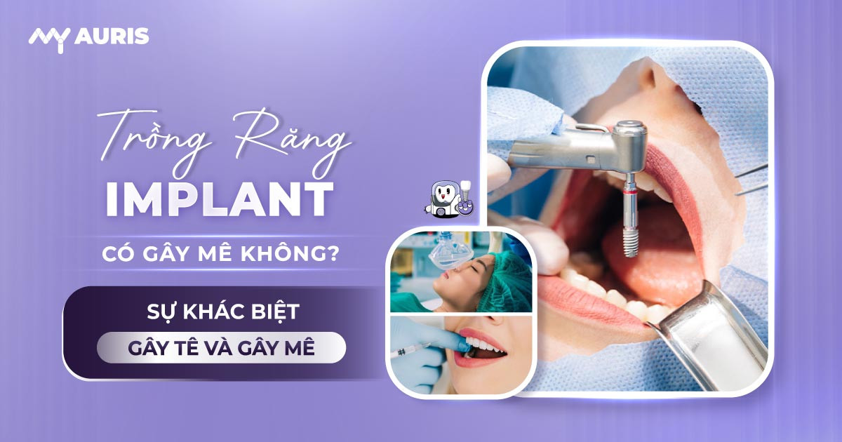 trồng răng implant có gây mê không