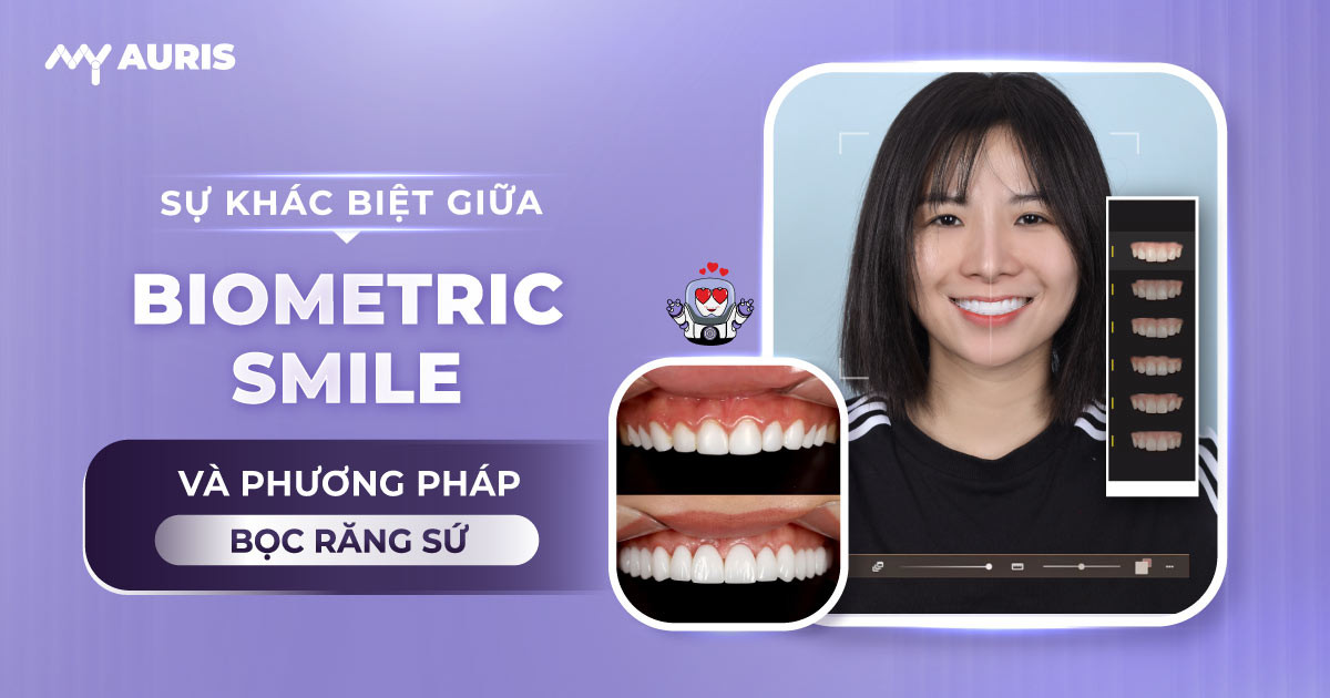 BioMetric Smile vs bọc sứ truyền thống,quy trình minh bạch nha khoa,bọc răng sứ VIP