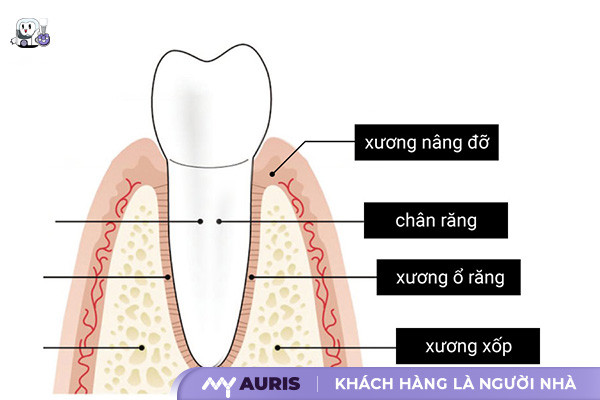 cấu tạo implant