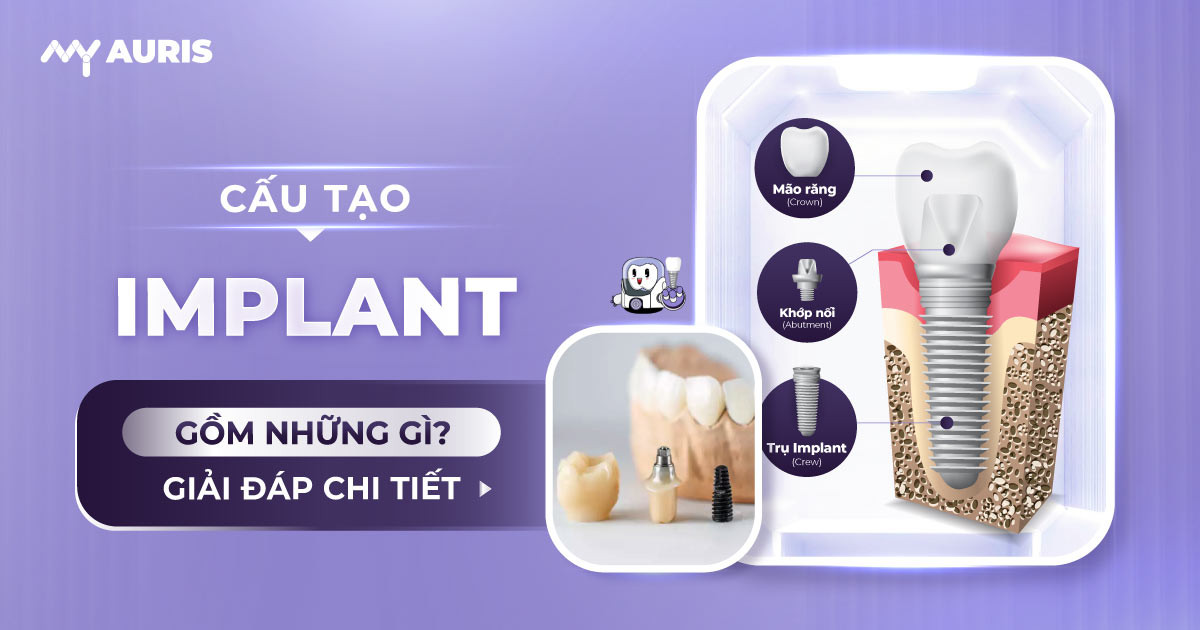 cấu tạo implant