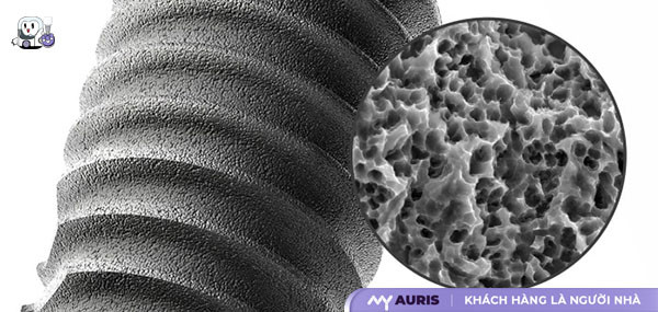 trụ implant,các loại trụ implant,implant,kích thước trụ implant,loại vật liệu nào giữ vị trí quan trọng nhất,trụ implant nào tốt