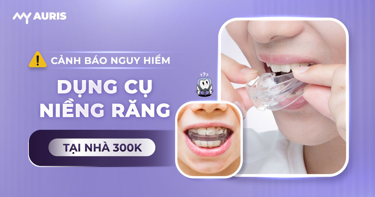 dụng cụ niềng răng tại nhà 300k có hiệu quả không