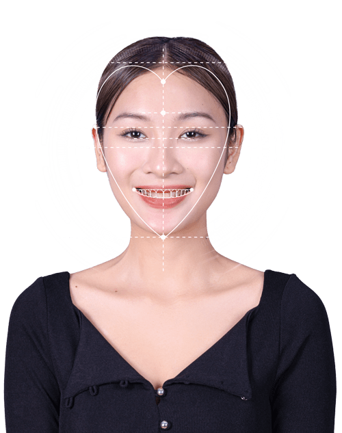 bọc răng sứ tiếng trung là gì