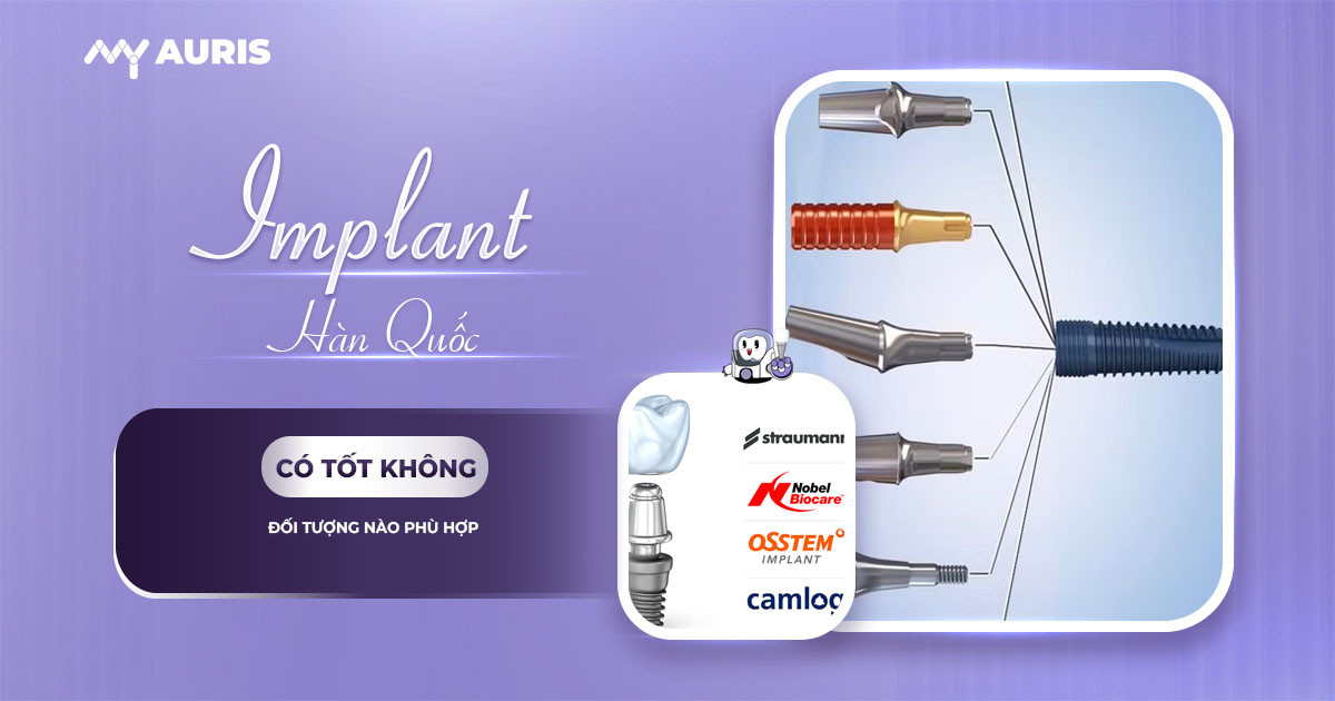 implant hàn quốc có tốt không, trồng răng implant hàn quốc có tốt không