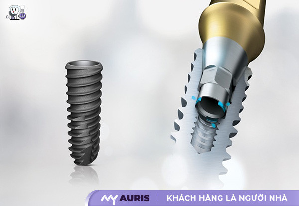 implant hàn quốc có tốt không,trồng răng implant hàn quốc có tốt không