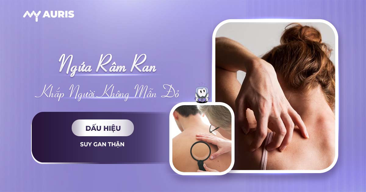 ngứa râm ran khắp người không nổi mẩn